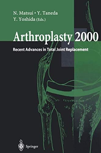 健康・医学 Revision Total Hip Arthroplasty Revision Total Hip Arthroplasty: 9780387983912: Medicine & Health