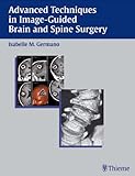 Advanced Techniques in Image-Guided Brain and Spine Surgery, , 3131315210