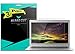 Toshiba Chromebook 13.3 Screen Protector [3-Pack], Klear Cut High Definition Matte Screen Protector for Toshiba Chromebook 13.3 PET Film Anti-Glare and Anti-Bubble Shield