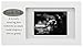 Malden International Designs Sneak Peek Sonogram Juvenile Frame, 4x6, White