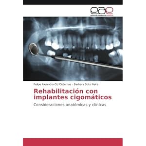 Rehabilitación con implantes cigomáticos: Consideraciones anatómicas y clínicas (Spanish Edition)