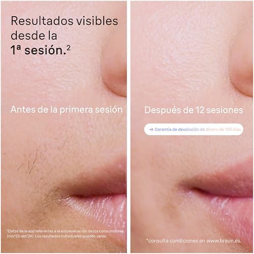 Depiladora Luz Pulsada Skin i·expert Smart IPL, PL7387, Blanco/Bronce
