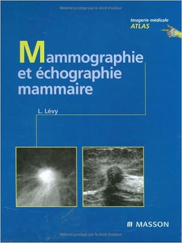 Téléchargement Gratuit Du Livre Mammographie Et échographie - 