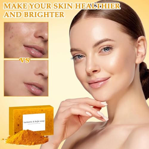 LBOYLOVE® Lemon Turmeric Kojic Soap, Turmeric Soap Bar for Face ＆ Body，Natural Turmeric Handmade Soap for All Skin Types（2pcs)