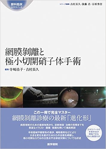 価格が安い 網膜硝子体手術 イラスト眼科手術シリーズ 6 単行本 国内店舗正規品 Pnlp Sn