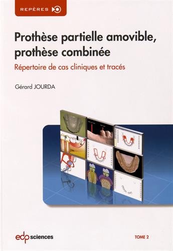 Prothèse partielle amovible, prothèse combinée