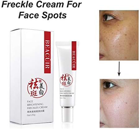 Matoen Freckle Cream Skin Brightening Cream Dark Spot Corrector Remover Removes Hyperpigmentation Reduces Melasma Lightens Anti Wrinkle