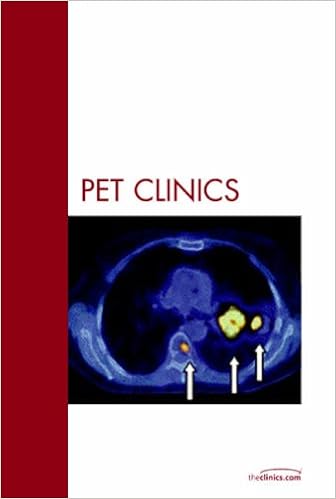 Lung Cancer, An Issue of PET Clinics (The Clinics: Radiology) Lung Cancer, An Issue of PET Clinics (The Clinics: Radiology)
