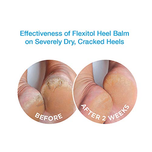 Flexitol Heel Balm - Image 8