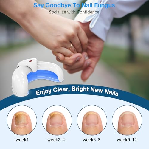 Suuprone Nail Fungus Laser Device, Anti-Fungal Nail Treatment for Toenails/Fingernails Extra Strong, Enhanced Antifungal Laser with 905nm Infrared Light + 470nm Blue Light-White