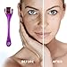 PREMIUM Derma Roller - Cosmetic Needling Instrument for Face and Body, 540 Titanium Microneedles 0.3mm - Effective and Safe Kit w/ Storage Case