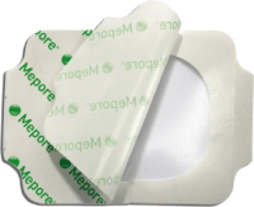 Molnlycke Health Care Mepore Mefilm Self-adhesive Transparent Film Dressing 4" x 10" (Box of 20 Each)