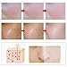 Whitening Cream, Freckle cream, Skin Brightening Cream, Bleaching Cream, Freckle Fade Removal, Dark Spot Corrector Remover, Whitens, Nourishes, Repairs & Restores Skin