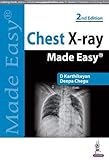 Chest X-Ray Made Easy