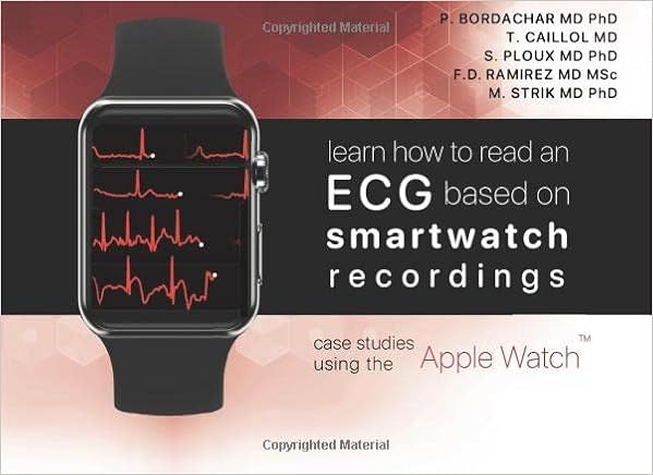 an ECG based on smartwatch recordings 