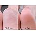 Moisturizing Gel Heel Socks to Treat Cracked Feet Fast Soft Gel Lined Toeless Spa Socks 3 Pairs for Women to Heal Dry Heels Pink