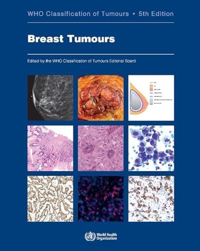 Amazon.com: WHO Classification of Tumours of Endocrine Organs [OP