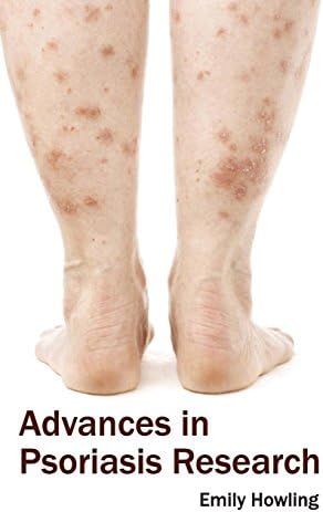 Advances in Psoriasis Research