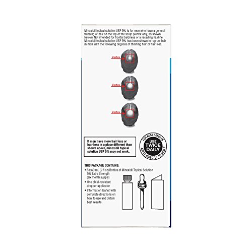 4 Basic+Care+Minoxidil+Solution+Treatment