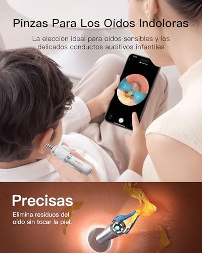Bebird Limpiador de Oídos con Otoscopio Digital HD, Cámara Flexible, 6 Luces LED, IP67, Inalámbrico WiFi, Recargable, Kit de Limpieza de Cerumen Compatible con iOS y Android para Adultos Niños (Blanco)