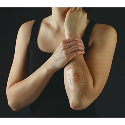 NEXCARE TEGADERM TRANSPARENT DRESSING, CLEAR FILM LETS YOU SEE WOUNDS HEAL, WATERPROOF DRESSING HOLDS FAST FOR 7 DAYS – 10 DRESSINGS