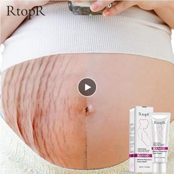 body acne scars products