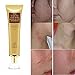 Scar and Acne Spots Mark Removal Gel Cream Face Care Acne Treatment Whitening Moisturizing Facial Cream 30ml