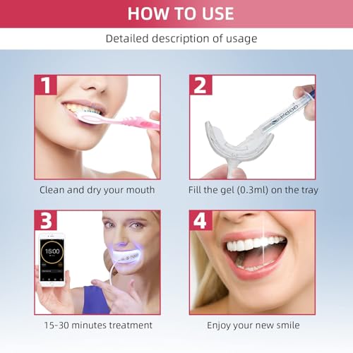 Teeth Whitening Kit - Wired LED Teeth Whitening Set with 5 x 3 ml PAP+ Gel - Direct USB Power Supply without Battery - Professional Teeth Bleaching at Home - More Effective than Whitening Strips