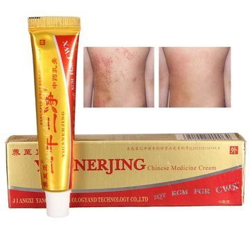 Natural Chinese Herbal Medicine Cream Eczema Dermatitis - Import It All