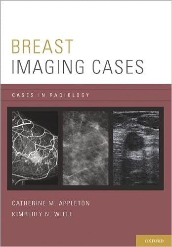 Breast Imaging Cases Cases In Radiology Kindle Edition By Appleton Catherine M Wiele Kimberly N Professional Technical Kindle Ebooks Amazon Com Breast Imaging Cases Cases In Radiology Kindle Edition By Appleton Catherine M Wiele Kimberly N Professional Technical Kindle Ebooks Amazon Com