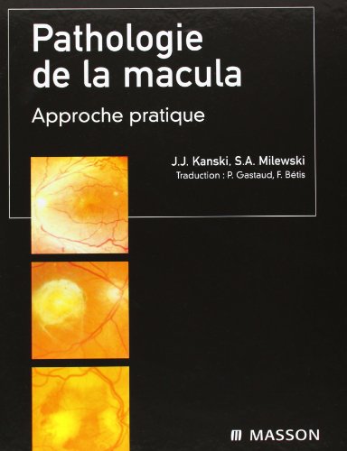 Pathologie de la macula