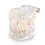 Removable Adult Teeth Study Dental Pathological Disease Implant Teaching Typodont Model - Dentist Standard
