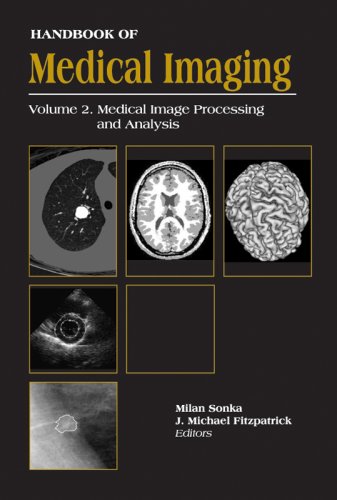 Handbook of Medical Imaging, Volume 2. Medical Image Processing and Analysis (Parts 1 and 2) (SPIE Press Monograph Vol. PM80/SC)