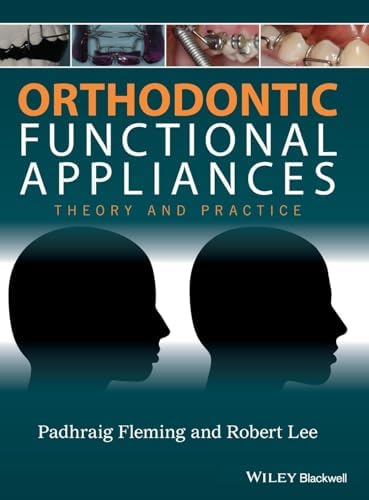 Functional Occlusion: From TMJ to Smile Design: 9780323033718
