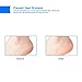 Shovan Vented Gel Heel Socks Feet Care Moisturizing Treatment Sleeves for Dry Hard Cracked Heels