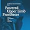Powered Upper Limb Prostheses Control Implementation And