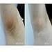 Ultra Brightening Spotless Oil Skin Care Natural Pure Remove Ance (2pcs)