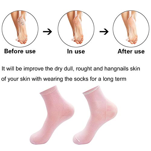 Elutong 3 Pairs Soft Gel Heel Socks Ventilate Stealth Hosiery Or Dry Hard Cracked Skin Moisturizing Day Night Care Skin Calluses, Cuticles, Rough Skin - Thumbnail 4