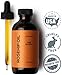Eve Hansen Pure Rosehip Oil for face - Natural Moisturizing Oil w/Vit C for Skin, Hair, Nails - Face oil and body oil to reduce fine lines/wrinkles, acne scars, stretch marks and dark spot removal