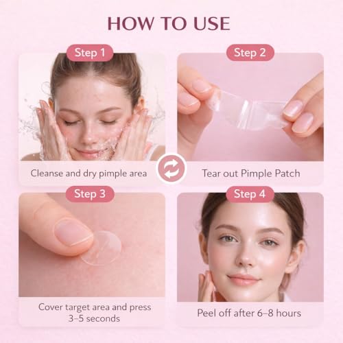 Primebly™ Acne Patches 360 Count | Pimple Patch & Hydrocolloid Patch لصقات حب الشباب | Invisible Waterproof for Face & Body | Fast-Acting Blemish & Acne Spot Treatment – Vegan & Cruelty-Free