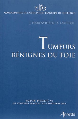 Tumeurs bénignes du foie