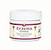 Eczema Ointment, 40gm, a Natural Treatment for Eczema, Psoriasis and Dermatitis, Instant Relief for Dry, Itchy Skin, Helps Minimize Scarring (Acne Scars Too), Doesn't Cause Stinging