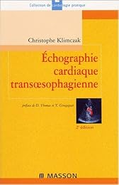 Échographie cardiaque transoesophagienne