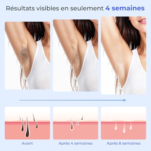 21J Pulsed Light Hair Remover, IPL Laser Epilator with Cooling Function, Home Salon, 9 Levels Laser Hair Removal for Women and Men, Armpit Body, White