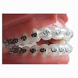 Our Bestseller Dental Orthodontic Lip Guard Cover Protector - Pain Reliever