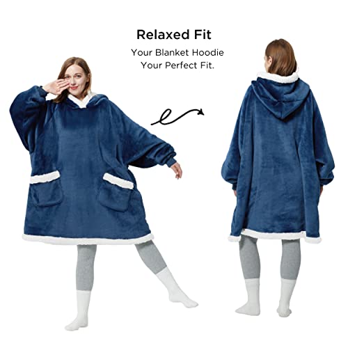 Bedsure Wearable Blanket Hoodie Sherpa Fleece Hooded Blanket for