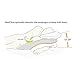 MedCline Reflux Relief System, Bed Wedge Pillow for Acid Reflux and GERD Relief, Therapeutic Body Pillow with Insert and Covers, Inclined Sleep Position with Arm Pocket, Large for 6'0