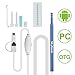 Skybasic Ear Otoscope Inspection Camera 3 in 1 USB Ear Cleaning Endoscope Tool Visual Earpick Digital Earwax Removal Spoon with 6 LED for Micro USB,USB-C Android Phone,Windows MAC PC
