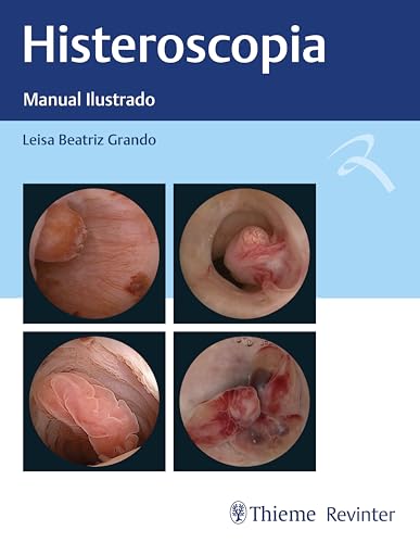 Histeroscopia: manual ilustrado