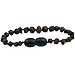 Baltic Amber Teething Bracelet/Teething Anklet For Babies, Toddlers & Kids (Unisex, Raw Unpolished Cherry, 5.5